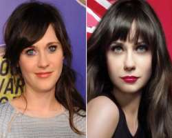 Zooey Deschanel before surgery